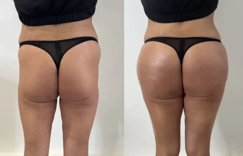 LUVORA BREAST & HIP ENHANCING CREAM